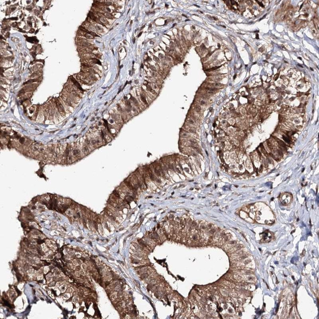 FAM53B Antibody in Immunohistochemistry (Paraffin) (IHC (P))