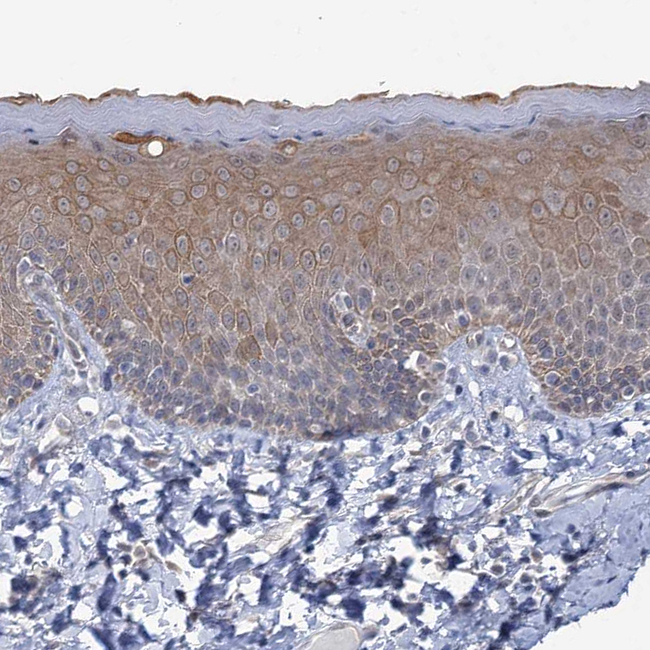 MBLAC2 Antibody in Immunohistochemistry (Paraffin) (IHC (P))