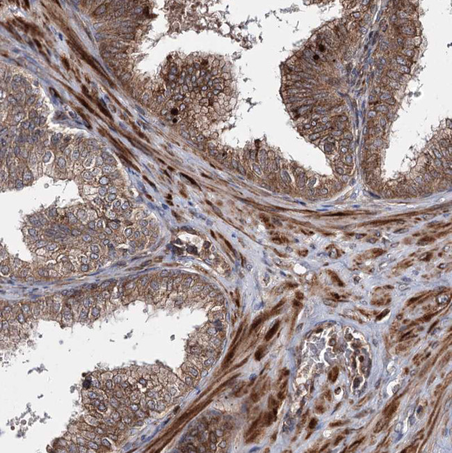 HECTD2 Antibody in Immunohistochemistry (Paraffin) (IHC (P))