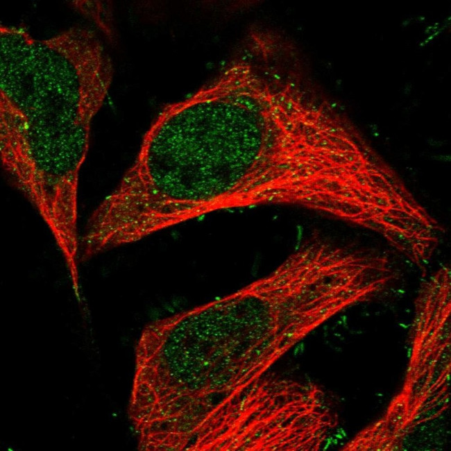 TRAPPC13 Antibody in Immunocytochemistry (ICC/IF)