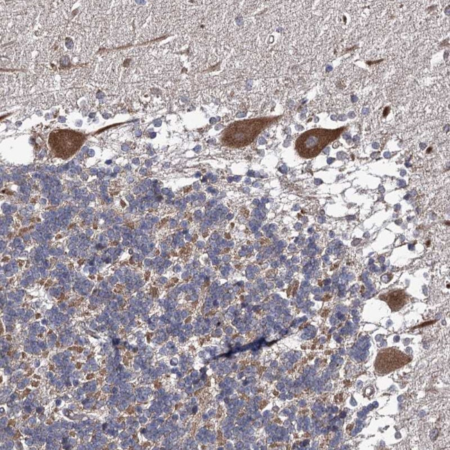 DYDC1 Antibody in Immunohistochemistry (Paraffin) (IHC (P))