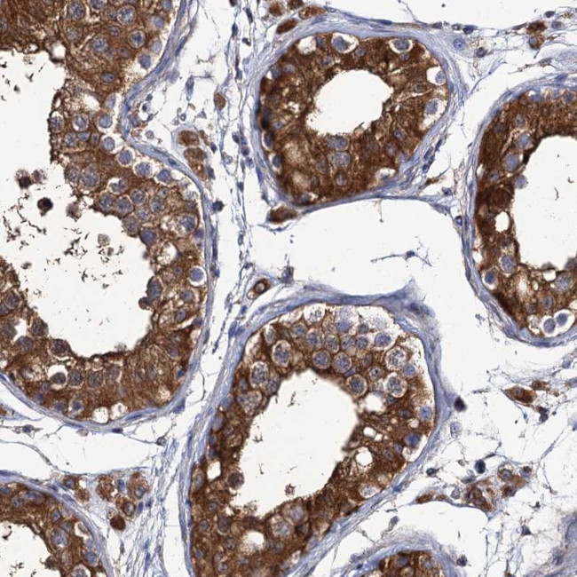 DYDC1 Antibody in Immunohistochemistry (Paraffin) (IHC (P))