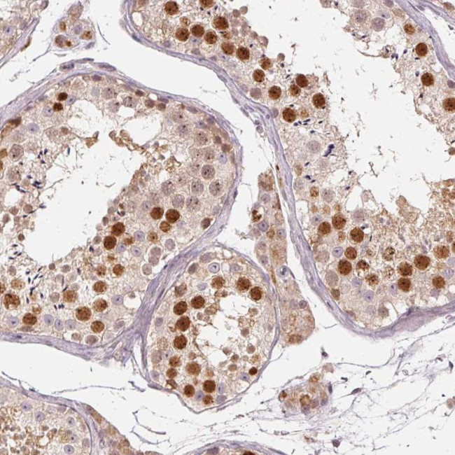 TTC23L Antibody in Immunohistochemistry (Paraffin) (IHC (P))