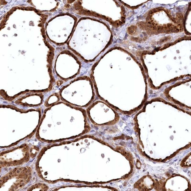 SERGEF Antibody in Immunohistochemistry (IHC)