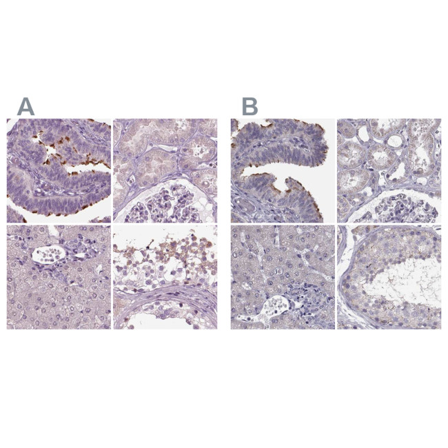 ARMC3 Antibody in Immunohistochemistry (IHC)