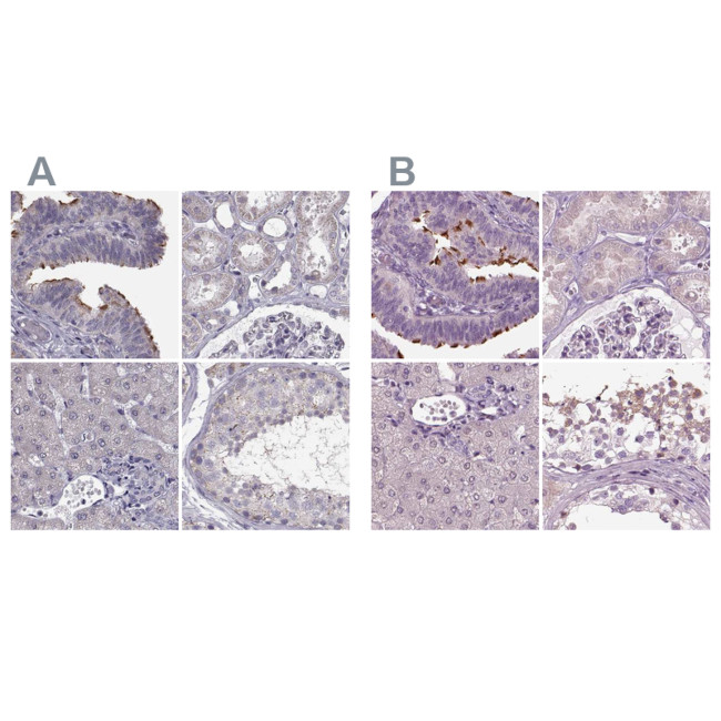 ARMC3 Antibody in Immunohistochemistry (IHC)