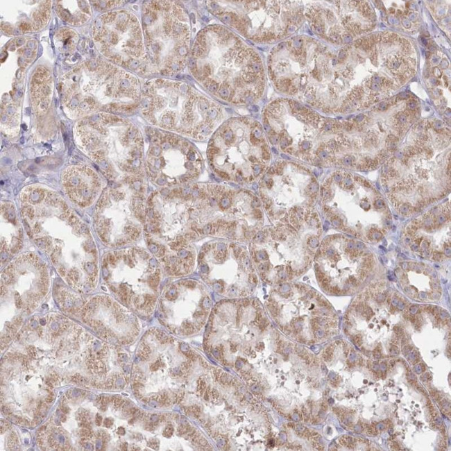 MTG1 Antibody in Immunohistochemistry (Paraffin) (IHC (P))