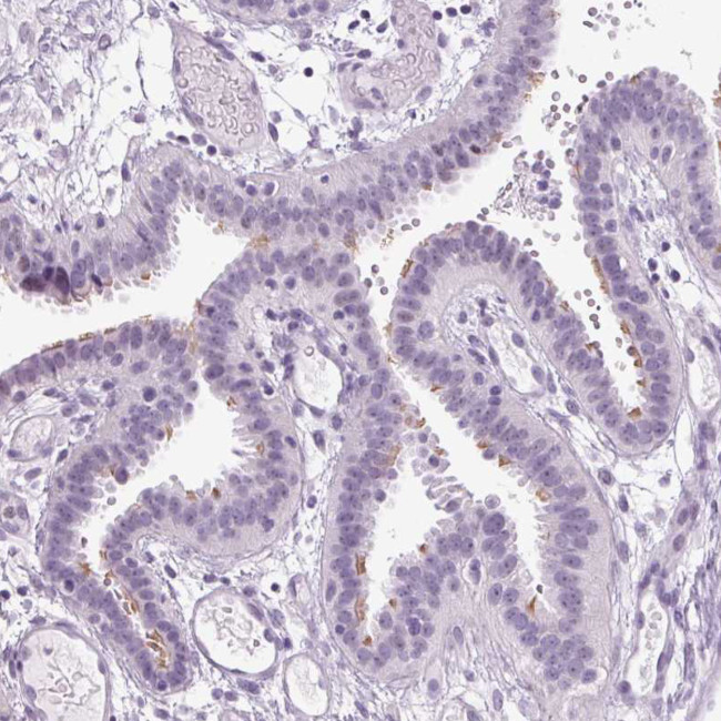 ARMC4 Antibody in Immunohistochemistry (Paraffin) (IHC (P))