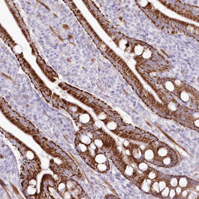 ZFAND4 Antibody in Immunohistochemistry (Paraffin) (IHC (P))