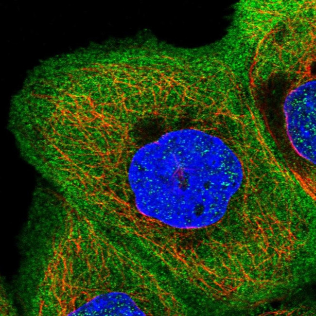 AFAP1L2 Antibody in Immunocytochemistry (ICC/IF)