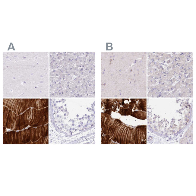 MYOZ1 Antibody in Immunohistochemistry (IHC)