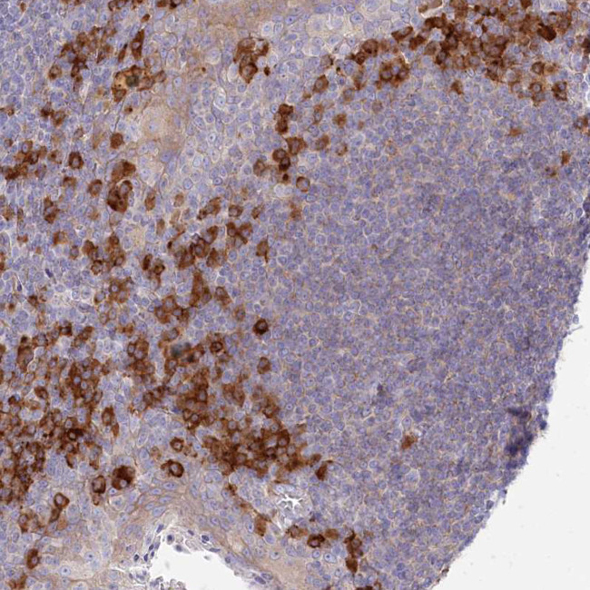 POGLUT1 Antibody in Immunohistochemistry (Paraffin) (IHC (P))