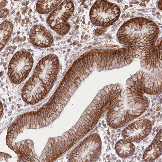 XYLB Antibody in Immunohistochemistry (Paraffin) (IHC (P))