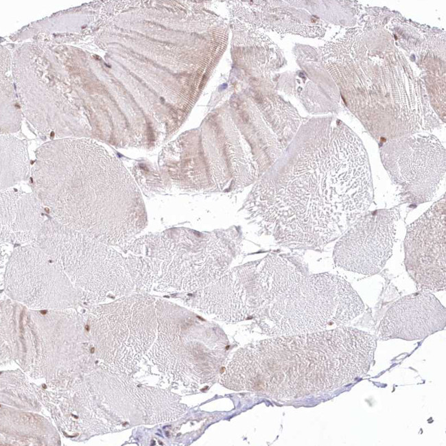 NSUN2 Antibody in Immunohistochemistry (Paraffin) (IHC (P))