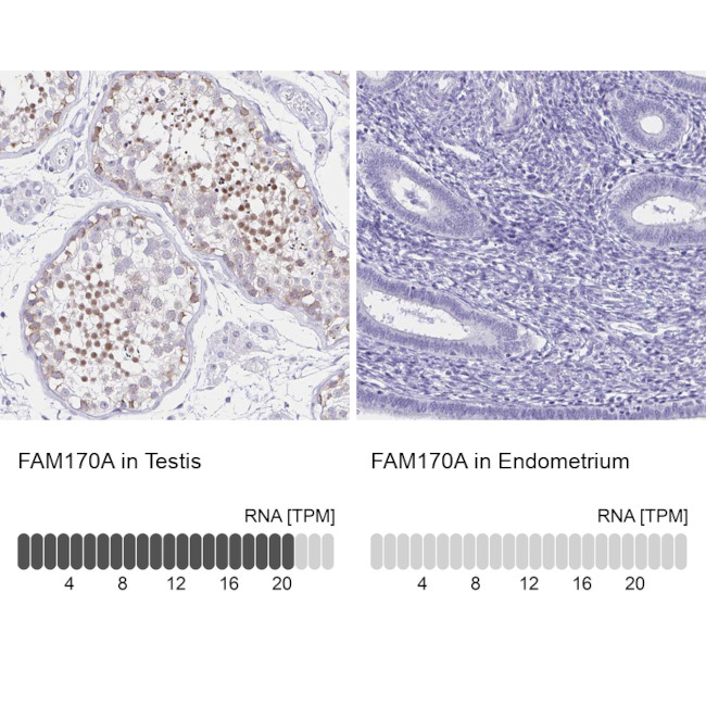 FAM170A Antibody in Immunohistochemistry (IHC)