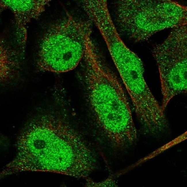 SKI3 Antibody in Immunocytochemistry (ICC/IF)