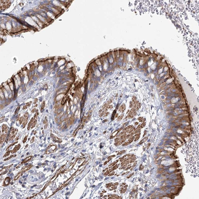 IFT46 Antibody in Immunohistochemistry (Paraffin) (IHC (P))