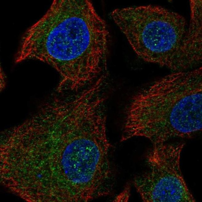 ANKRD16 Antibody in Immunocytochemistry (ICC/IF)