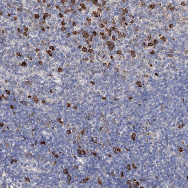 ANKRD16 Antibody in Immunohistochemistry (Paraffin) (IHC (P))