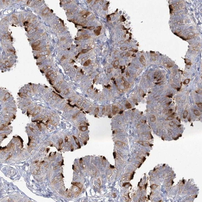 ENO4 Antibody in Immunohistochemistry (Paraffin) (IHC (P))