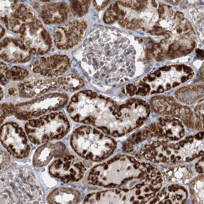 DHTKD1 Antibody in Immunohistochemistry (Paraffin) (IHC (P))