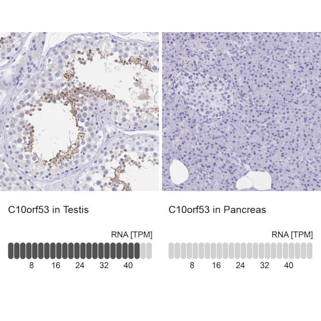 C10orf53 Antibody in Immunohistochemistry (IHC)
