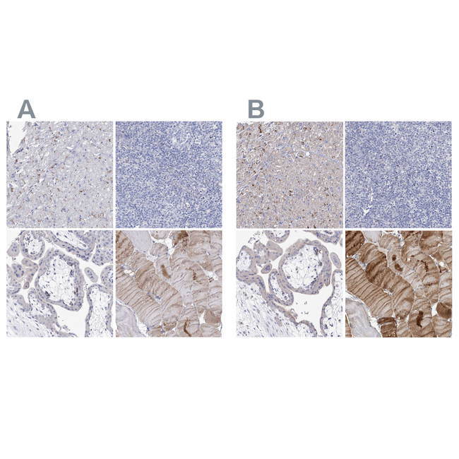 NRAP Antibody in Immunohistochemistry (Paraffin) (IHC (P))