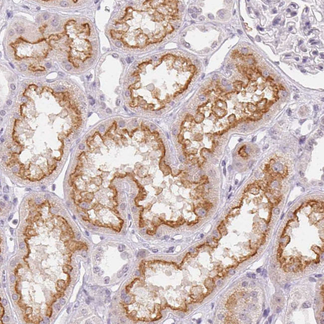 TMEM174 Antibody in Immunohistochemistry (Paraffin) (IHC (P))
