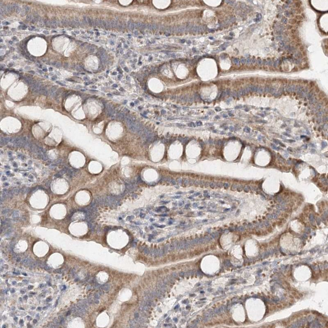 RUFY4 Antibody in Immunohistochemistry (Paraffin) (IHC (P))