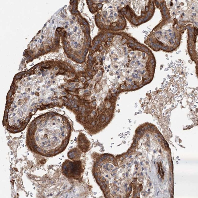 RAPGEF6 Antibody in Immunohistochemistry (Paraffin) (IHC (P))