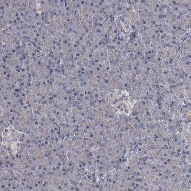 FLVCR2 Antibody in Immunohistochemistry (Paraffin) (IHC (P))
