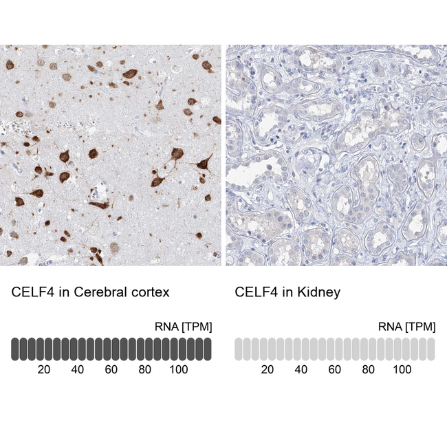 BRUNOL4 Antibody in Immunohistochemistry (Paraffin) (IHC (P))