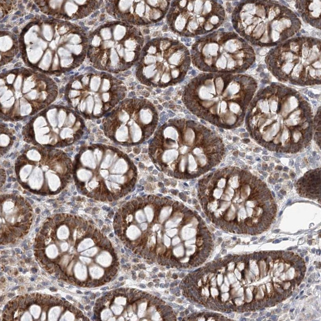 RNF150 Antibody in Immunohistochemistry (Paraffin) (IHC (P))