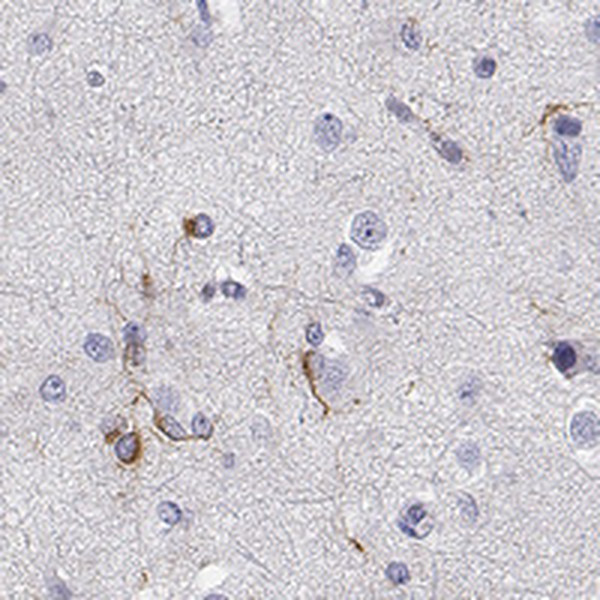 MAP6D1 Antibody in Immunohistochemistry (IHC)