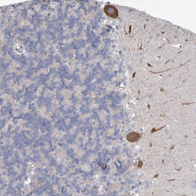 MEPE Antibody in Immunohistochemistry (Paraffin) (IHC (P))