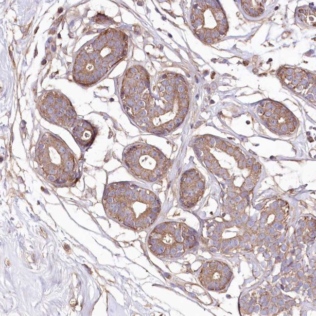 WWC1 Antibody in Immunohistochemistry (Paraffin) (IHC (P))