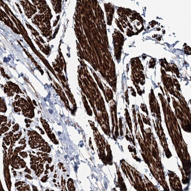 SUMF1 Antibody in Immunohistochemistry (Paraffin) (IHC (P))