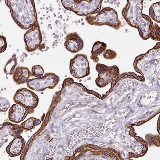 Dynactin 4 Antibody in Immunohistochemistry (IHC)