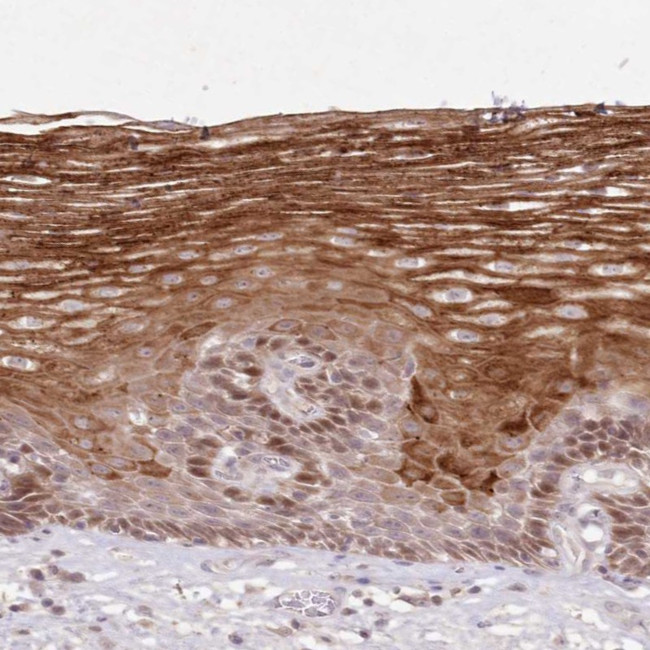 ASCC1 Antibody in Immunohistochemistry (Paraffin) (IHC (P))