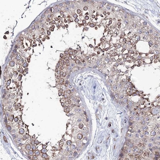 PUS3 Antibody in Immunohistochemistry (Paraffin) (IHC (P))