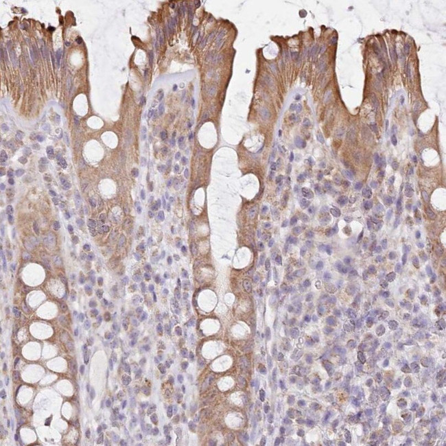 FAM208B Antibody in Immunohistochemistry (IHC)