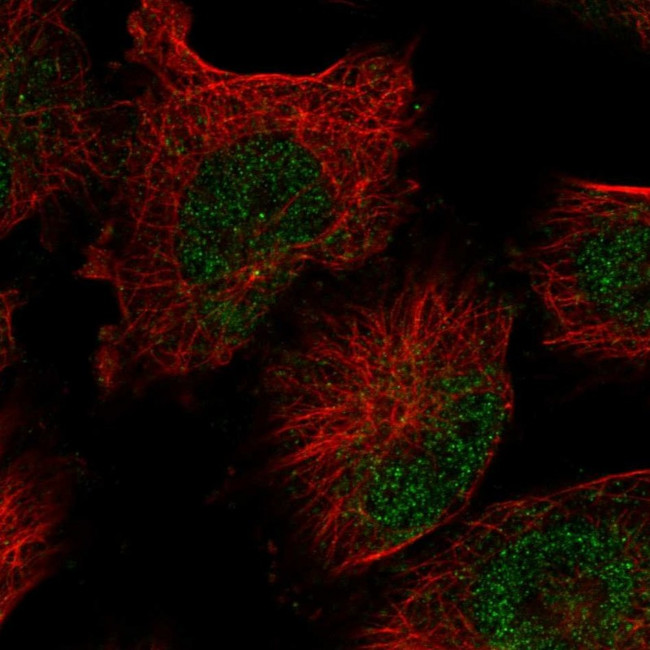 FAM208B Antibody in Immunocytochemistry (ICC/IF)