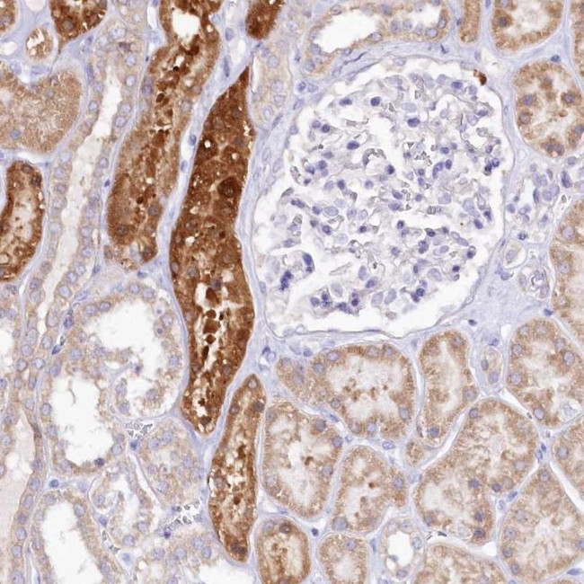 PTER Antibody in Immunohistochemistry (IHC)