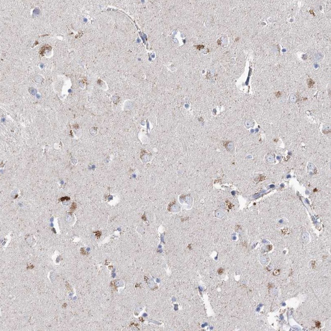 LRRC14B Antibody in Immunohistochemistry (Paraffin) (IHC (P))