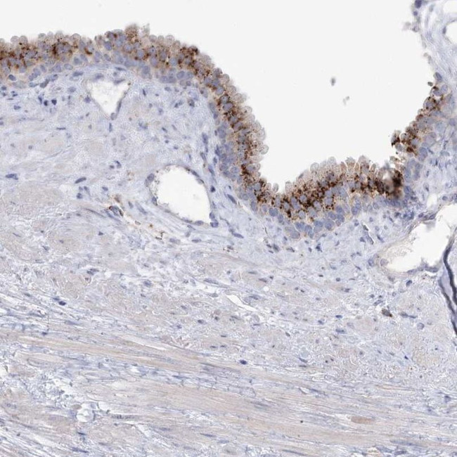 SIAE Antibody in Immunohistochemistry (IHC)