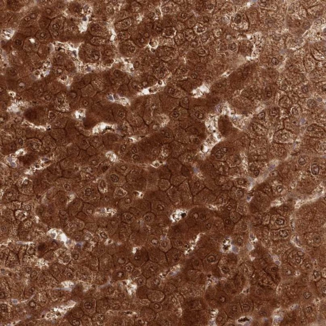 GBE1 Antibody in Immunohistochemistry (IHC)