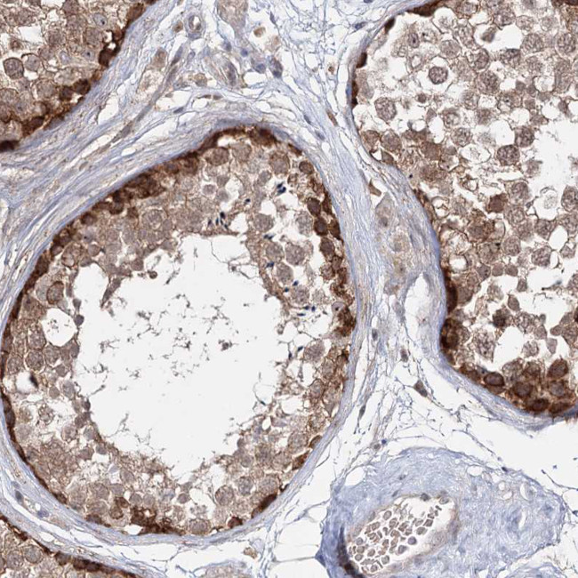 WDR44 Antibody in Immunohistochemistry (Paraffin) (IHC (P))