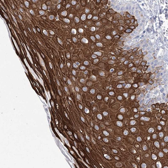 Girdin Antibody in Immunohistochemistry (Paraffin) (IHC (P))