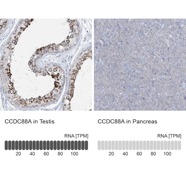 Girdin Antibody in Immunohistochemistry (IHC)