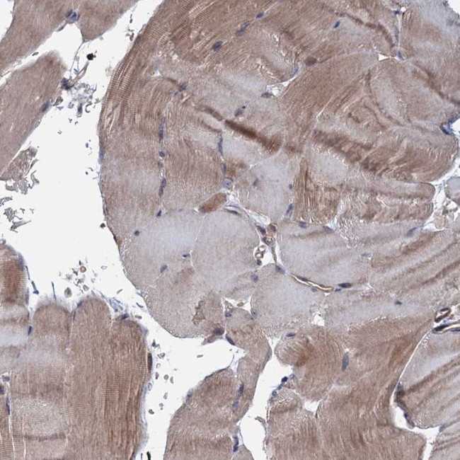MTRR Antibody in Immunohistochemistry (Paraffin) (IHC (P))